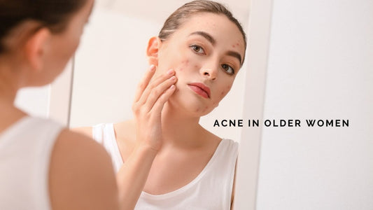 Health & Beauty: Acne In Older Women - DWC Magazine: Strong Women, Strong Voices