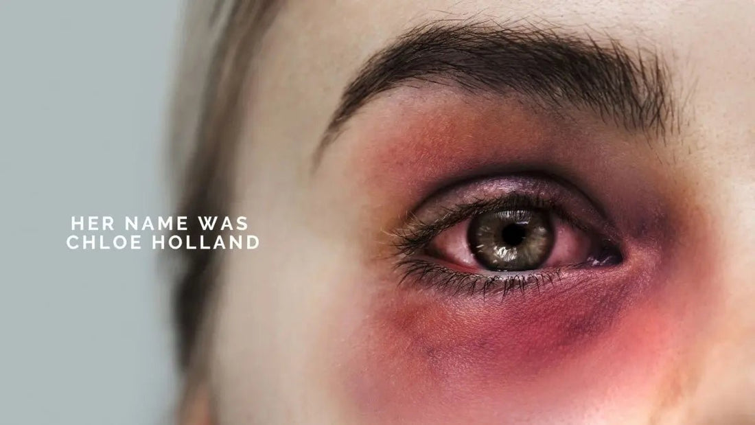 Scars that Shine: Chloe Holland, Coercive Control Law Petition - DWC Magazine